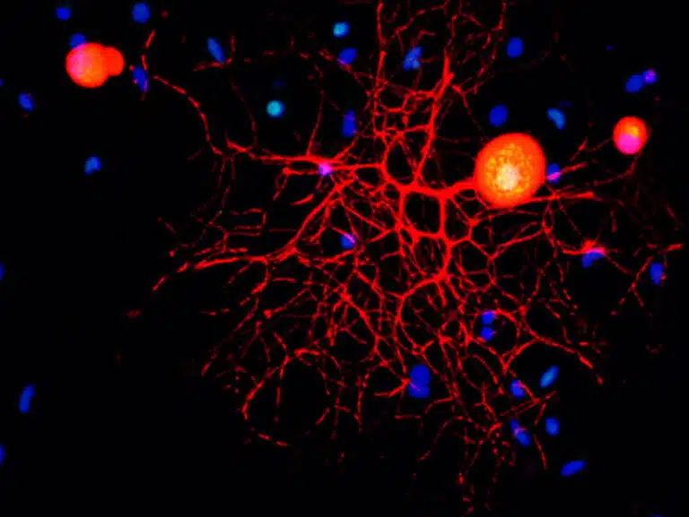 صورة مجهرية متحد البؤر للخلايا العصبية الحسية للجهاز العصبي المحيطي في الثقافة. بإذن من معهد وايزمان