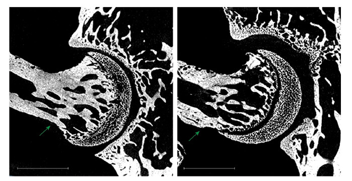 השתקת הגן Piezo2 בתאי העצב של מערכת הפרופריוספציה הובילה לעיוותים במפרק הירך בעכברים המהונדסים (מימין) בהשוואה למפרק ירך תקין (משמאל). צולם באמצעות מערכת מיקרו-CT