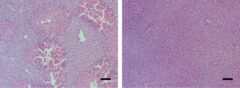 רקמת כבד עכבר תחת המיקרוסקופ. סימנים לאי ספיקת כבד חריפה (משמאל) נעלמו לאחר מתן תרופה החוסמת את חלבון הבקרה MYC
