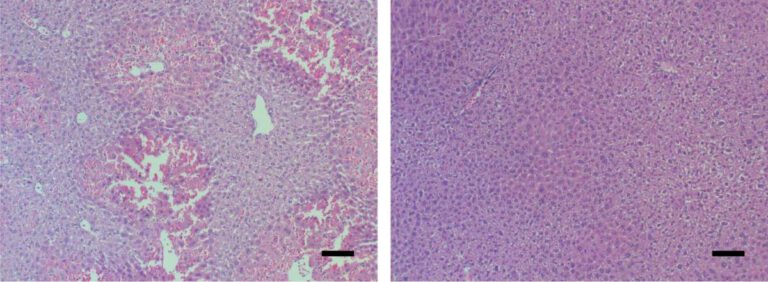 רקמת כבד עכבר תחת המיקרוסקופ. סימנים לאי ספיקת כבד חריפה (משמאל) נעלמו לאחר מתן תרופה החוסמת את חלבון הבקרה MYC