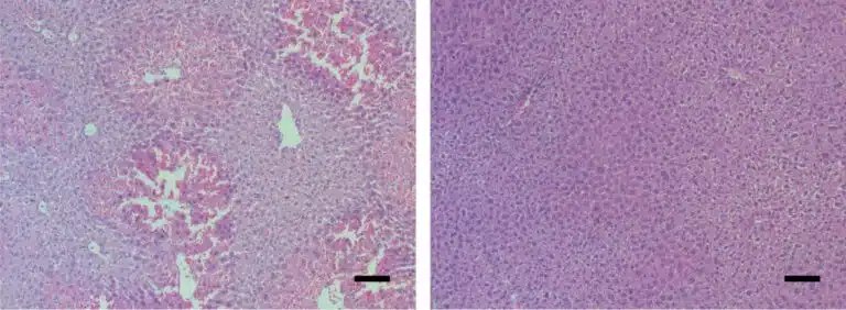 أنسجة كبد الفأر تحت المجهر. اختفت علامات فشل الكبد الحاد (يسار) بعد تناول دواء يمنع بروتين التحكم MYC