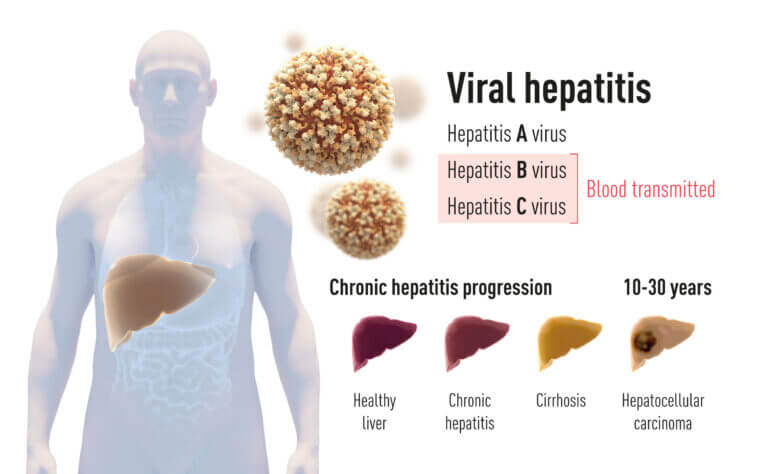 Explanation of the discovery of the hepatitis C virus. Image: Nobel Prize Committee