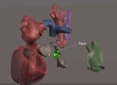 A virtual twin of the heart. Illustration: Dassault Systems