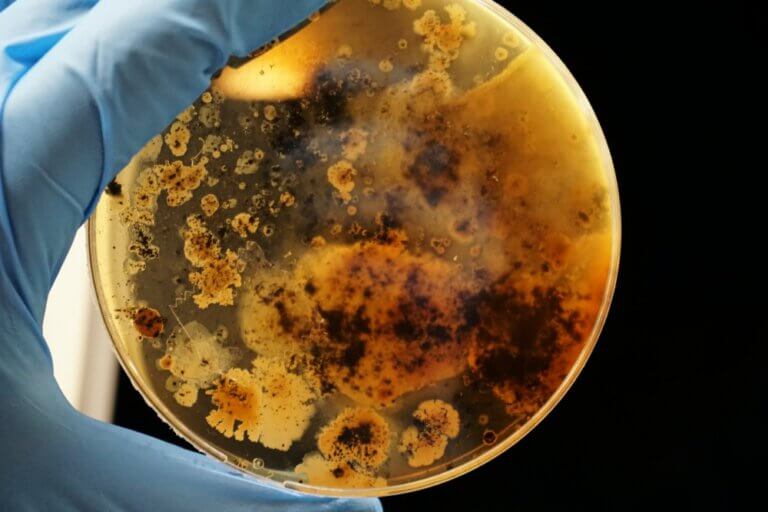 Growth of bacterial colonies. Adrian Lange, unsplash.com