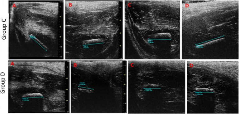 the implanted marker. From the scientific article