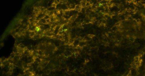חיידקי סלמונלה (ירוק בוהק) הנמצאים בתוך מקרופאגים (צהוב-חום) של עכבר. ד"ר רועי אברהם, מכון ויצמן