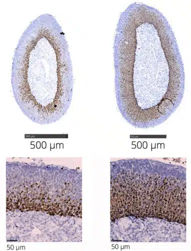 Adrenal gland in "stressed" mice (right) and normal mice (left). Chronic stress leads to a significant increase in the size of the gland and overexpression of the Abcb1b gene (marked in heat) in the inner part of the adrenal cortex