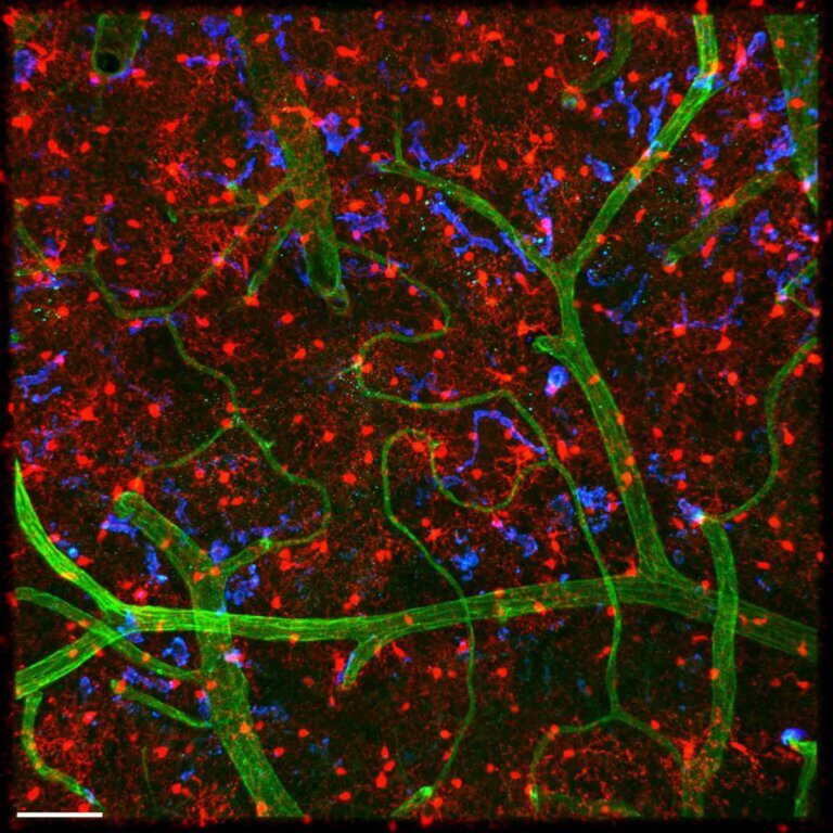 Mouse brain tissue. The octopus-like microglial cells are marked in red. In green - blood vessels. Courtesy of the Weizmann Institute