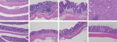 רירית המעי הגס של עכבר תחת מיקרוסקופ. הרירית של עכברים רגילים (למעלה, שמאל) משתבשת עם התקדמות הדלקת (למעלה, אמצע) ומקדמת את התפתחות הסרטן (למעלה, ימין). לעומת זאת, בעכברים ללא HSF1 (למטה, שמאל), לא מתפתחת דלקת (למטה, אמצע וימין)