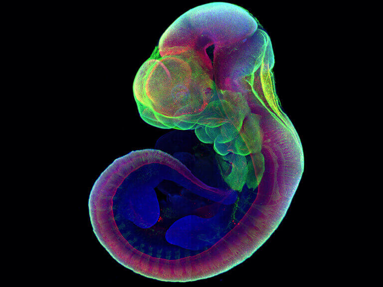 A mouse fetus grown six days outside the womb. His developing organs were marked with fluorescent genes
