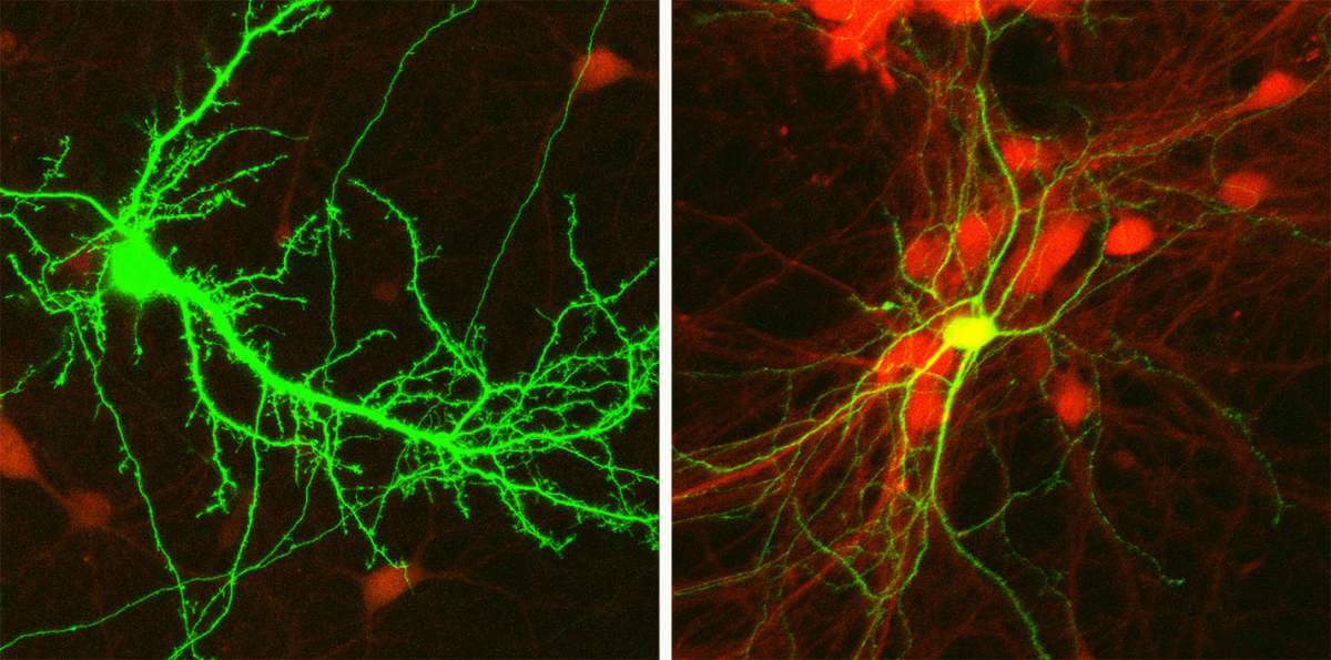 Neural networks grown in the laboratory, in which there are different ratios between the inhibitory neurons and the excitatory neurons (the proportion of inhibitory cells in the network, from right to left: 100%, 50% and 0). The inhibitory neurons were programmed to produce a red fluorescent signal with which the researchers distinguished between the two types of neurons