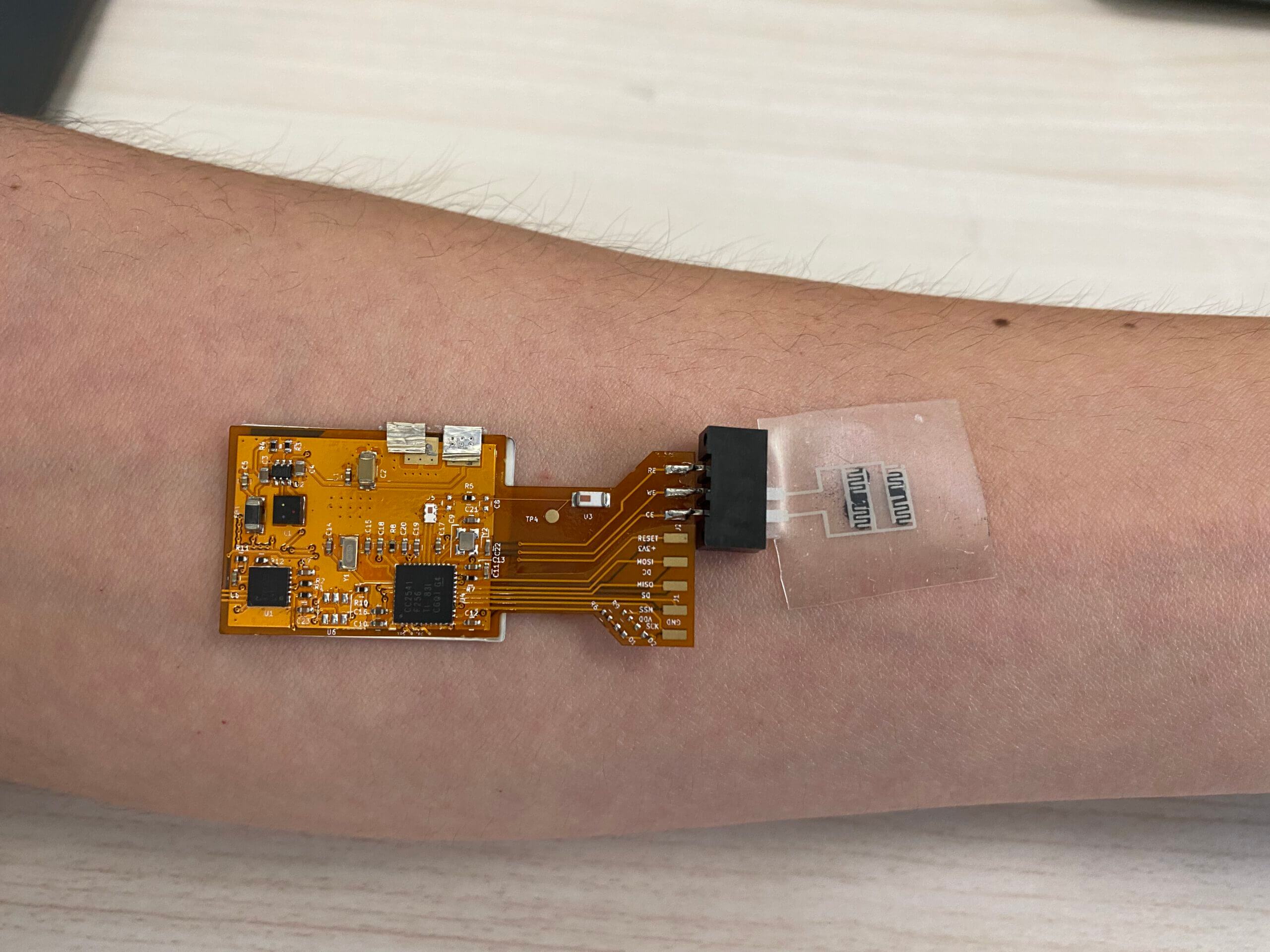 Tuberculosis monitoring using a sticker that sticks to the skin and measures the volatile particles emitted from it. Credit: Technion barges