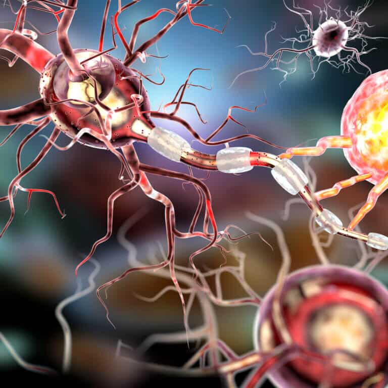 neurological disease. Illustration: depositphotos.com