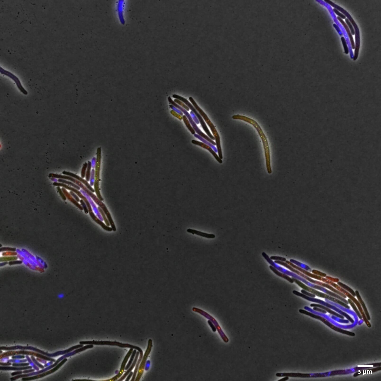  עיכוב חלוקה של חיידקים לאחר ביטוי של החלבון. צילום: ד"ר טרידיב מהאטה.
