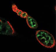ביציות בשלבי התפתחות מוקדמים במקטע שחלה של זבוב הפירות. בירוק – אברוני מיטוכונדריה שאינם פעילים, בצהוב-אדום – אברונים פעילים