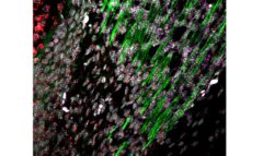 צילום מיקרוסקופ : צפיפות הצבעים ירוק-אדום-סגול מעידה על קיומם של תאים היברידיים בממשק הגיד-שריר. בירוק - סיבי השריר; באדום - האר-אן-איי של LOXL3 מתבטא בגיד ובצומת גיד-שריר. LoxL3 הוא אנזים הנמצא בקצות סיבי השריר המתפתחים ואחראי על בניית צומת הגיד שריר. בסגול - האר-אן-איי של MyoD מתבטא בתוך השריר עצמו. MyoD הוא גן האחראי להתמיינות תאי שריר. צילום באדיבות דוברות הטכניון