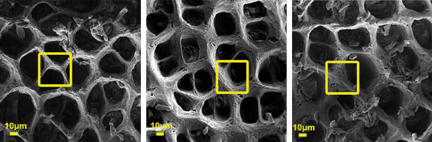 המרקם הבין-תאי במעי תחת מיקרוסקופ אלקטרונים סורק. משמאל: מרקם בריא, מימין – שינויים שחלו במרקם בשני מודלים של דלקת מעי בעכברים