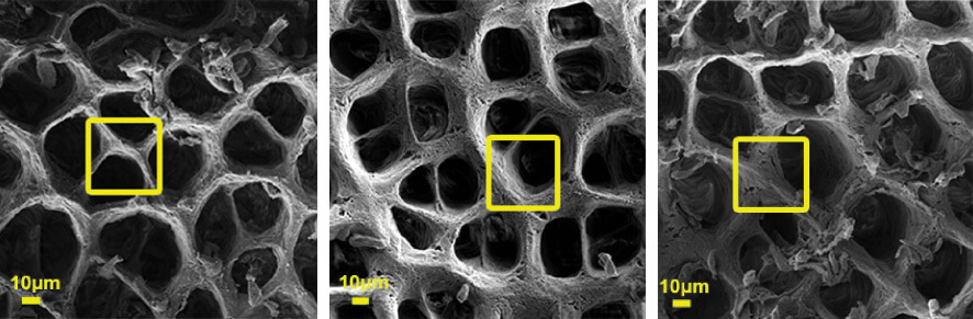 The intercellular tissue in the intestine under a scanning electron microscope. On the left: healthy texture, on the right - changes in the texture in two models of intestinal inflammation in mice