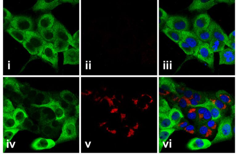 שורה עליונה: תאים המייצרים חלבונים חדשים (בירוק) טרם הדבקתם בנגיף הקורונה (בכחול – גרעיני התאים); שורה תחתונה: בתאים שנדבקו בקורונה (אדום) נפגע ייצור החלבונים התאיים