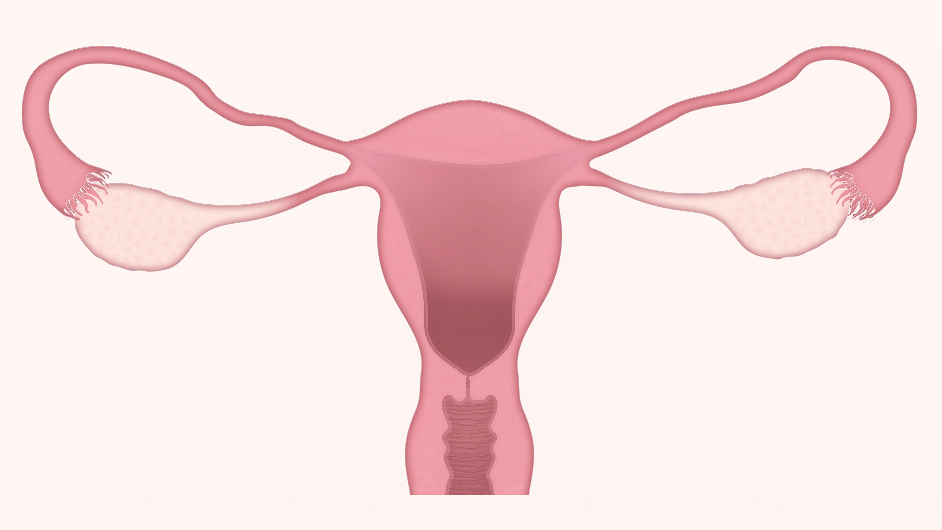 uterus, ovary, ovaries