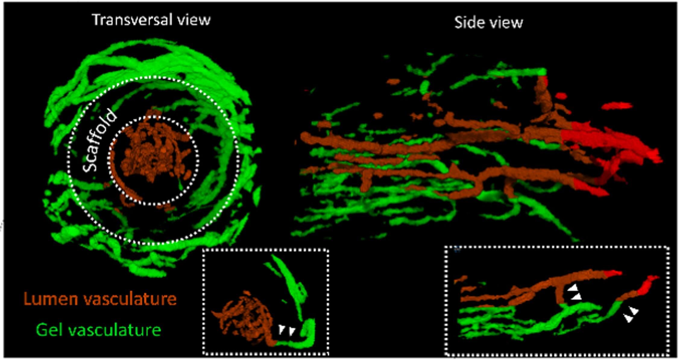 A snapshot (based on a micro CT scan) of the integration of the engineered scaffold into the tissue two weeks after implantation. Left: top view of the engineered coronary artery, located between the two dashed white lines. In red: the laminin protein that is mainly found inside the printed part and helps in the blood vessels. In green: blood vessels (mapped based on the presence of endothelial proteins). Right: side view. Courtesy of the Technion spokesperson, Prof. Levenberg's lab