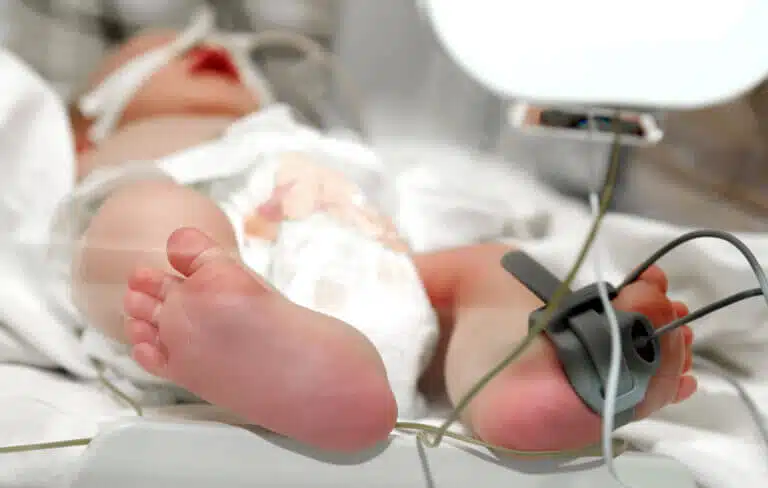 A baby born by forceps is lying in an incubator. Illustration: depositphotos.com