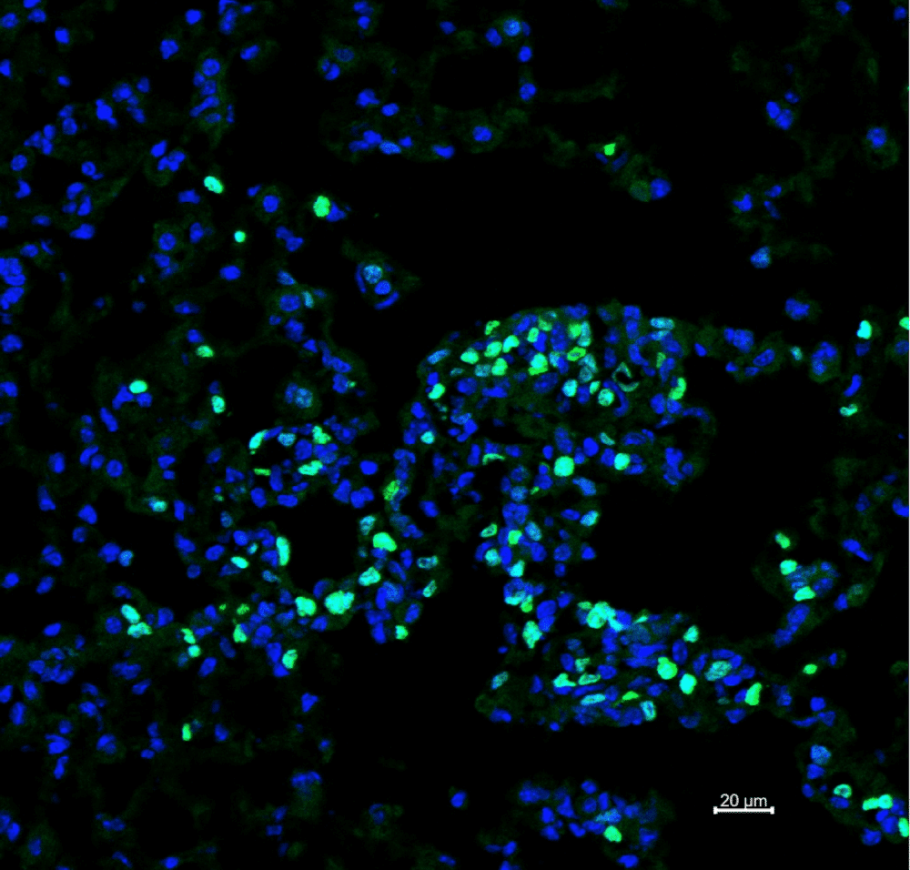שגשוג של תאים סרטניים בעכברים ללא אאוזינופילים קרדיט: אוניברסיטת תל אביב