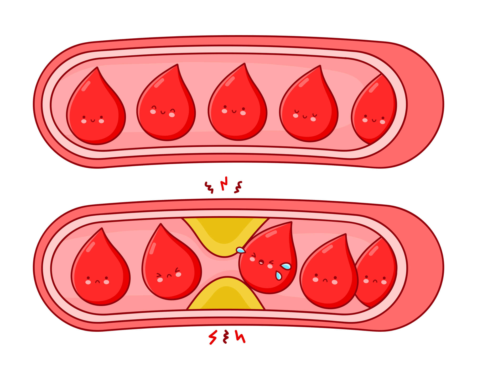 כלי דם בריאים לעומת כלי דם סתומים. <a href="https://depositphotos.com. ">המחשה: depositphotos.com</a>
