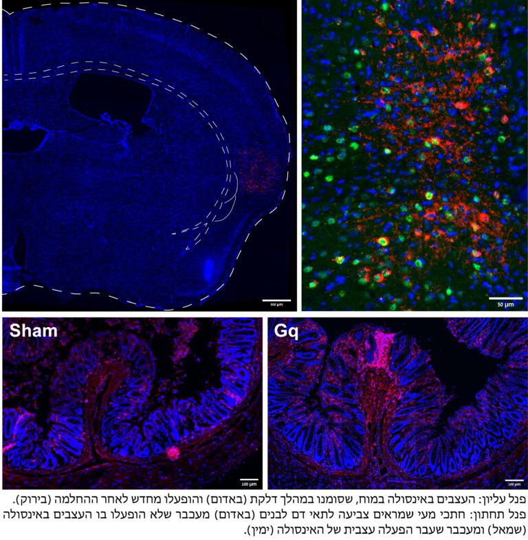 Microscope image. Above: the nerves in the insula that were labeled during inflammation (in red) and reactivated after recovery (in green). Below: Intestinal sections showing staining of white blood cells (in red) in a mouse that underwent neural activation of the insula (right) and in a mouse that did not undergo such activation (left). Courtesy of the Technion