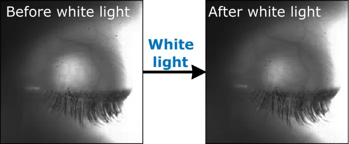 (In the picture: on the left, before illumination with white light, the pupil is clearly visible as a bright circle against the background of the closed eyelid. On the right, after illumination with white light, the pupil has shrunk and the spot of light is correspondingly smaller. During the research, a method for image processing was also developed in order to reconstruct the diameter of the pupil from the two images).