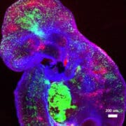 עובר עכבר עם תאים אנושיים (בירוק) התורמים להתפתחותו. תאים אלה התמקמו בעיקר באזורי הלב והמוח