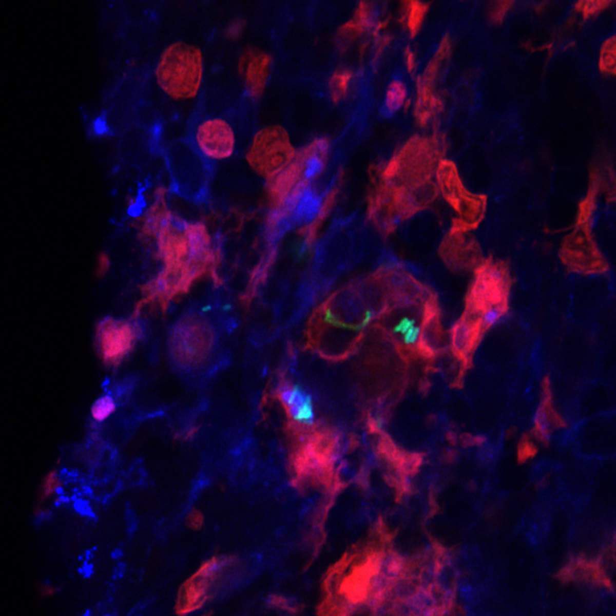 צילום מיקרוסקופי פלואורסצנטי של חיידקי סלמונלה (ירוק) שנבלעו על-ידי תאים מקרופאגים (אדום) שמקורם בטחול העכבר (בכחול – גרעיני התאים)