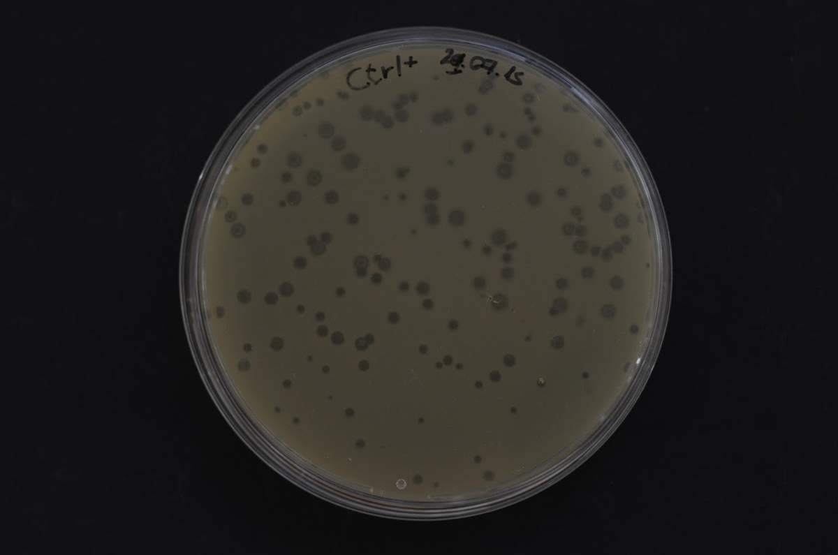  כלי מעבדה עם חיידקים אשר חלקם הודבקו בפאג'ים ומתו (נקודות כהות). החיידקים נלחמו בפולשים באמצעות מנגנוני הגנה הדומים לאלה של צמחים