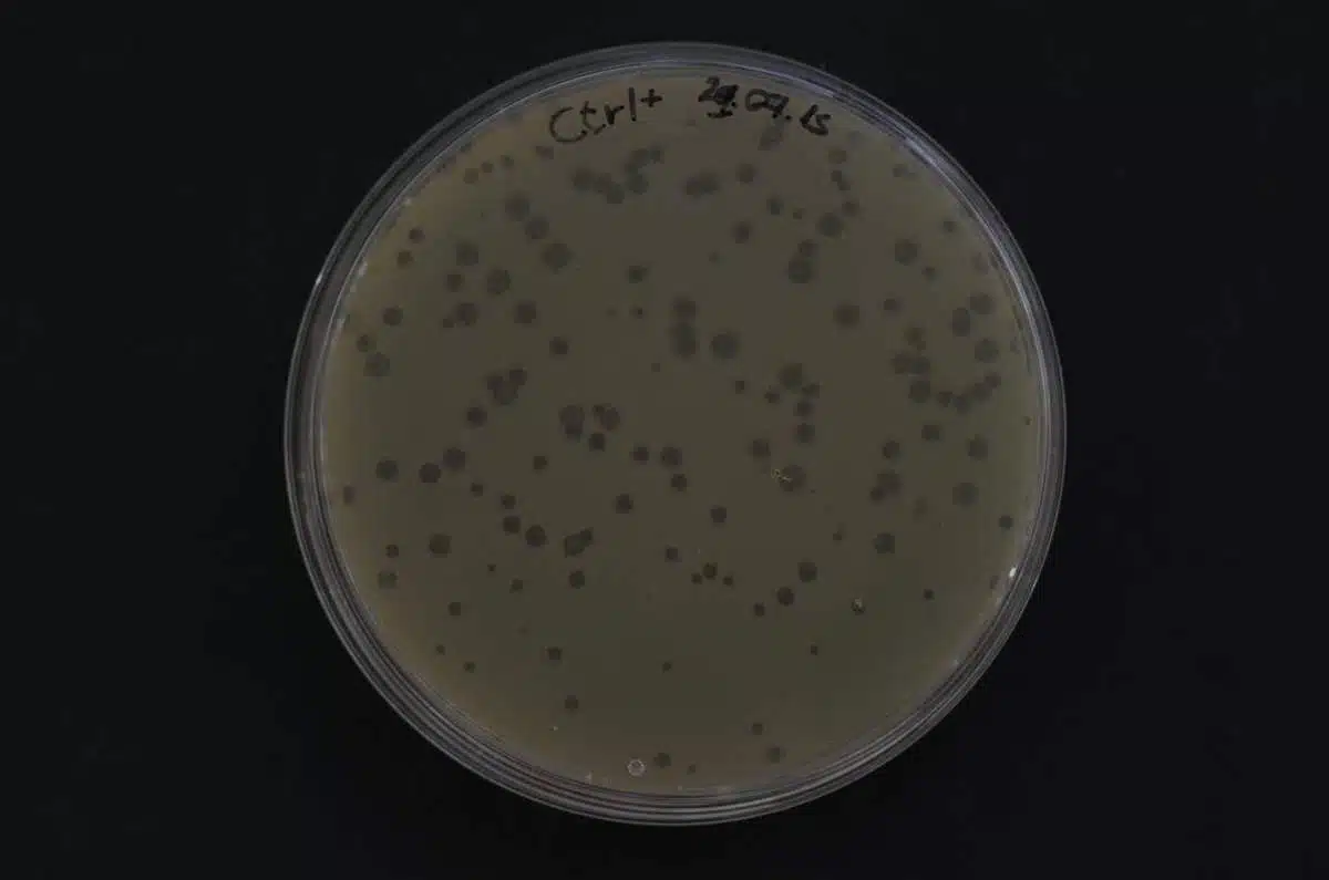 Laboratory vessels with bacteria some of which were infected with phages and died (dark dots). The bacteria fought the invaders using defense mechanisms similar to those of plants
