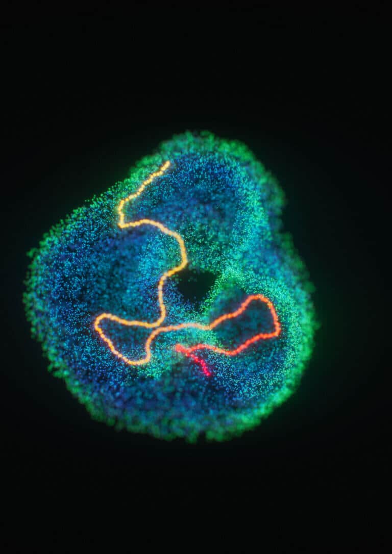 lattice cells. Photo courtesy of the Hebrew University