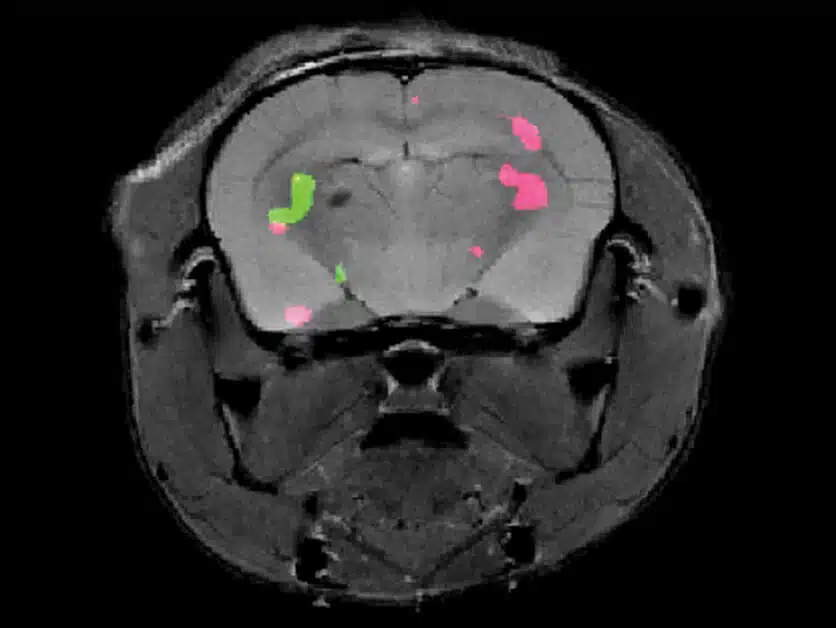 An MRI scan of a mouse brain shows with the help of two colors the expression of two different proteins. Weizmann Institute