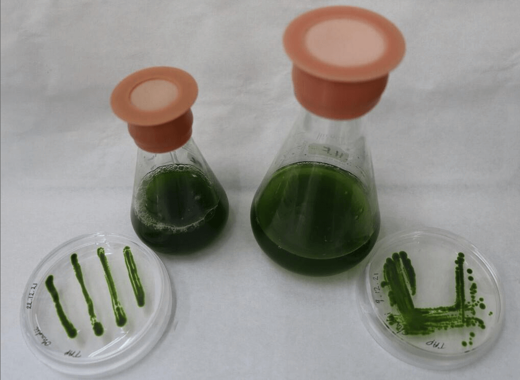 Chlorella Ohadi algae (photo: Tel Aviv University)