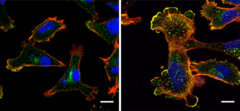 תאי סרטן שד המבטאים רמות גבוהות של NUP93 (שמאל) מפתחים מעין אצבעות העוזרות להם לנוע; לעומת זאת, תאים ללא NUP93 נייחים הרבה יותר (ימין)