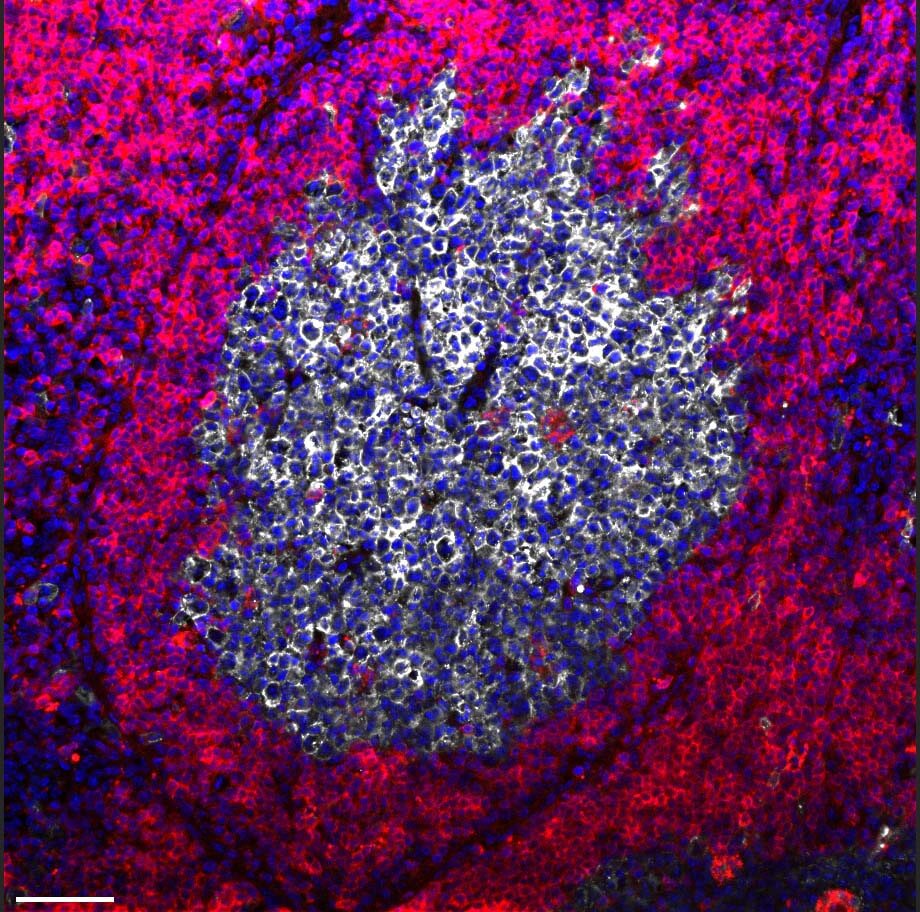 A germinal center within a lymph node, as revealed by confocal microscopy; In blue - the cell nuclei