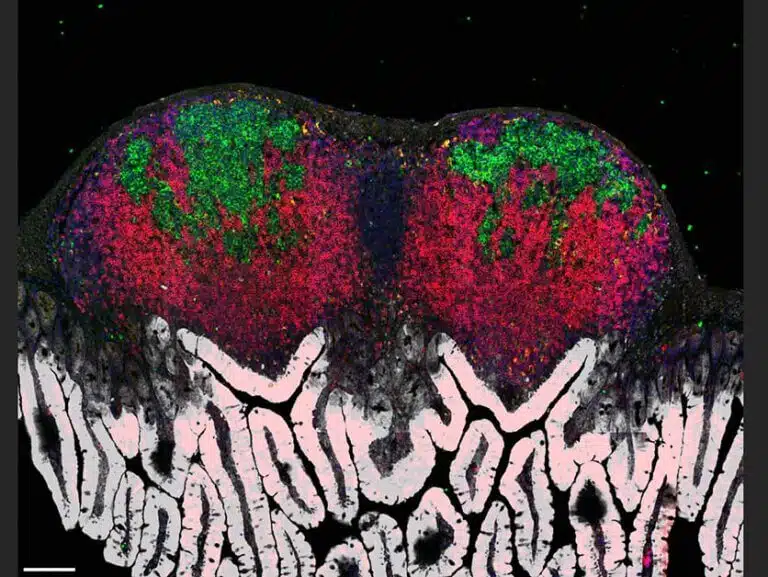 غشاء مخاطي معوي للفئران مبطن بنتوءات تشبه الإصبع (باللون الأبيض) ويحتوي على أعضاء لمفاوية (باللون الأحمر) تحتوي على مراكز جرثومية (باللون الأخضر). تم تصويره بواسطة المجهر متحد البؤر