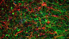 רשת נוירונים (צילום: מרכז סגול לביוטכנולוגיה רגנרטיבית)