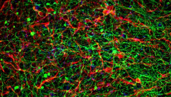 Neural network (photo: Sagol Center for Regenerative Biotechnology)