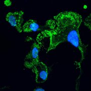 תאי מיקרוגליה ש"הובשלו" במעבדה מתאי גזע שמקורם בחולי ALS (בירוק), גרעיני התאים – בכחול. צולם באמצעות מיקרוסקופ קונפוקלי