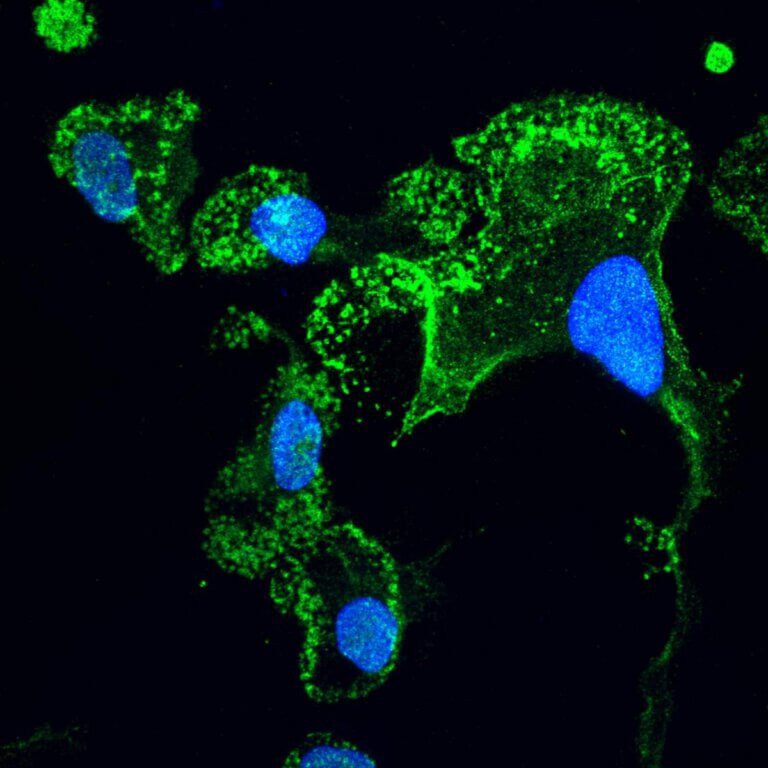 תאי מיקרוגליה ש"הובשלו" במעבדה מתאי גזע שמקורם בחולי ALS (בירוק), גרעיני התאים – בכחול. צולם באמצעות מיקרוסקופ קונפוקלי