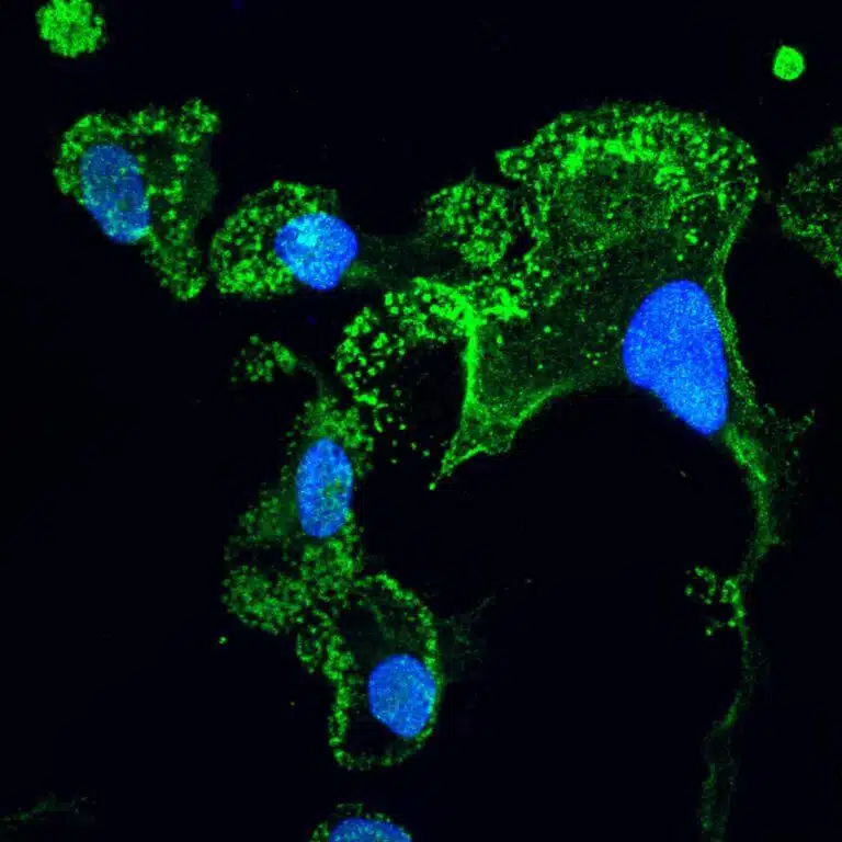 الخلايا الدبقية الصغيرة التي تم "إنضاجها" في المختبر من الخلايا الجذعية المستمدة من مرضى التصلب الجانبي الضموري (باللون الأخضر)، ونواة الخلية - باللون الأزرق. تم تصويرها باستخدام مجهر متحد البؤر