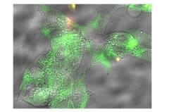 תאי סרטן מסומנים במולקולות גלאי זוהרות שפותחו במעבדתו של פרופ' מרגוליס