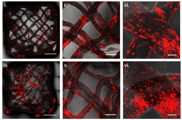 The images show the ability of the satellite cells to adhere and spread (in red) on scaffolds printed in 5D according to a predefined geometry, and were taken a week after they were seeded on the scaffolds. This process was observed both in scaffolds consisting of a combination of alginate with soy protein (top row) and in those consisting of a combination of alginate with pea protein (bottom row). In both cases, pictures were taken at different magnifications (10x - left and middle column; XNUMXx - right column). Prof. Shulamit Levenberg's lab, Technion