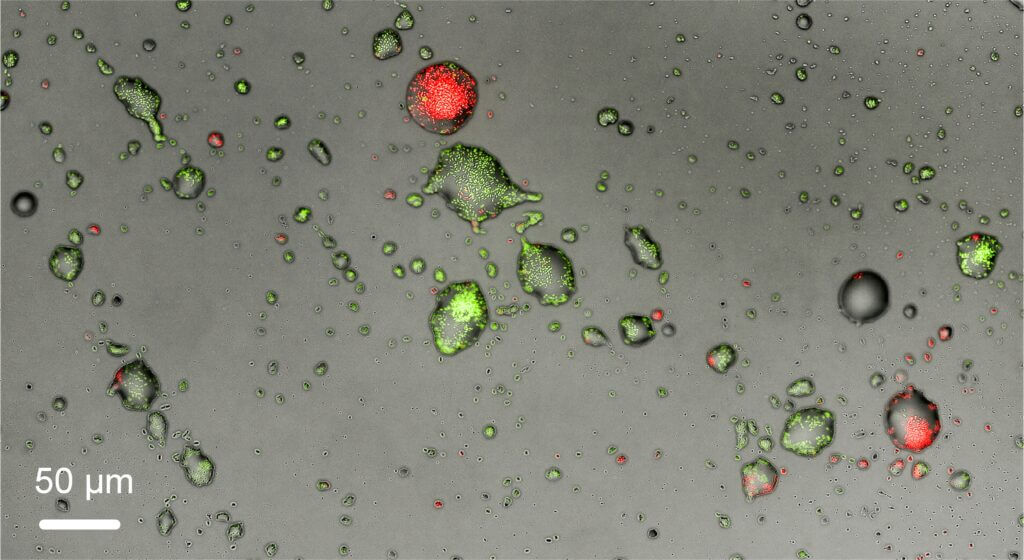 תמונת מיקרוסקופ המראה משטח ועליו טיפות מים זעירות, בלתי נראות לעין, המאוכלסות בחיידקים מסומנים בצבע זוהר. (צילום: ד"ר תומר עורבי)