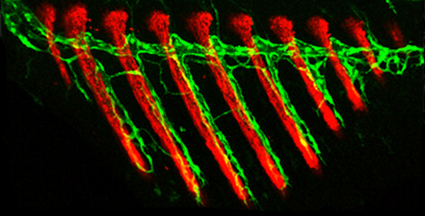תאים המייצרים רקמת עצם (באדום) וכלי לימפה (בירוק) בסנפיר מתפתח של דג זברה צעיר