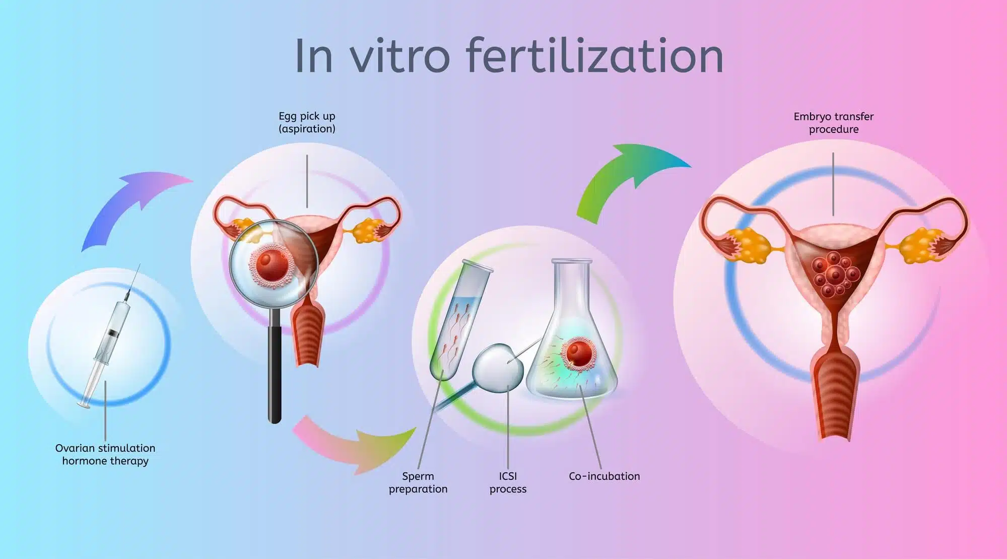 In vitro fertilization Photo: depositphotos.com